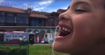 Siêu độc: Nhổ răng sữa cho trẻ em bằng... máy bay, máy khoan!