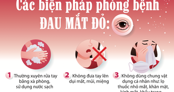 Bệnh đau mắt đỏ gia tăng: Những biện pháp phòng tránh bệnh đau mắt đỏ 