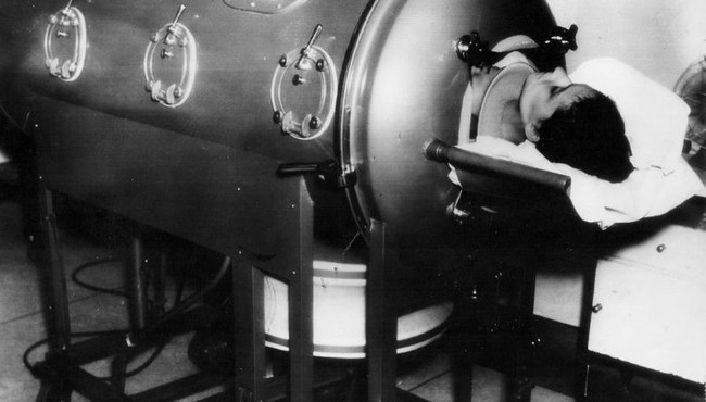 Biết gì về những máy thở đầu tiên trong lịch sử?